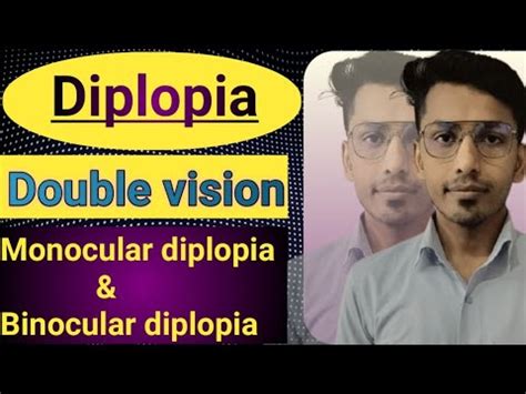 Diplopia Double Vision Difference Between Monocular Binocular