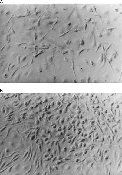 The Correlation Between Cytokine Production By Cerebral Cortical Glial