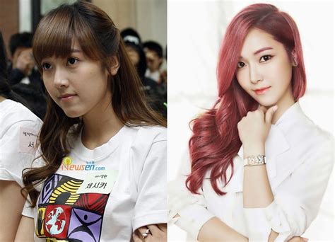 Korean Artist Plastic Surgery Before And After