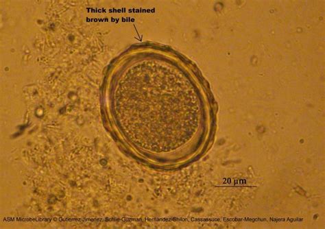 Fertilized Egg Of Ascaris Lumbricoides Labeled View Medical Laboratory Science Medical