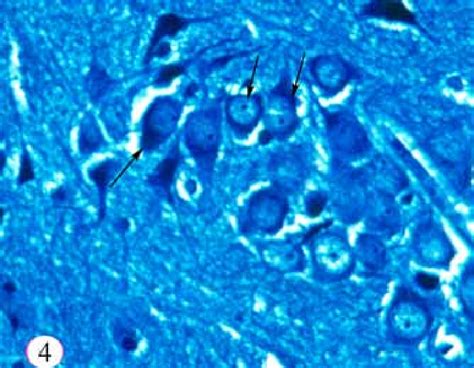 The Polymorphic Layer Of The Dentate Gyrus Containing Pyramidal Cells