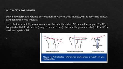 Fracturas Del Radio Distal De Miembro Superior Ppt