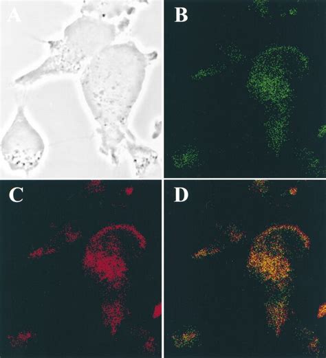 Double Labeled Indirect Immunofluorescence Microscopy Of ZR 82 Cells