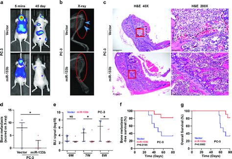 Upregulating MiR 133b Represses Bone Metastasis Of PC 3 Cells In Vivo