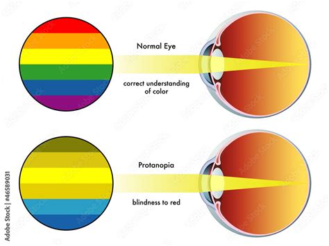 protanopia Stock Vector | Adobe Stock