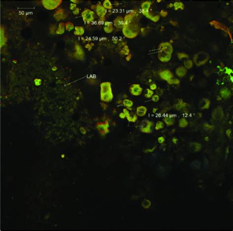 Confocal Laser Scanning Microscopy Images Of Co Microencapsulated