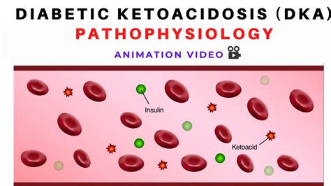 Pathophysiology Of Diabetic Ketoacidosis Dka Animation Diabetes