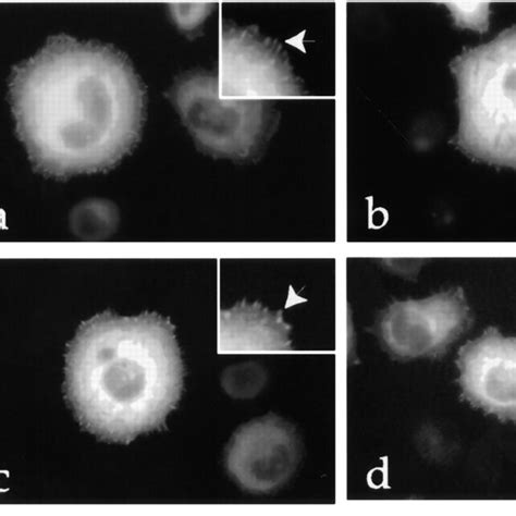 Adhesion And Spreading Of Clones Expressing Wild Type And Mutant Forms