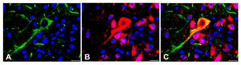 IJMS Free Full Text Intact Type I Interferon Receptor Signaling