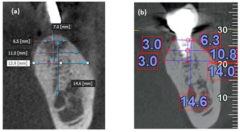 JPM Free Full Text Using Cone Beam Computed Tomography To Assess