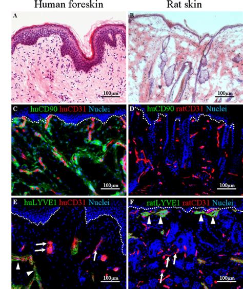 Evaluation Of Normal Human Foreskin And Rat Back Skin And The