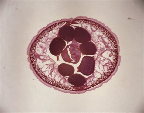 Symptoms of Intestinal Worms in Cats - Pets