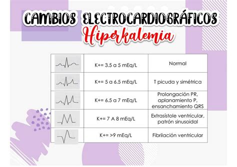 Cambios Electrocardiograficos Hiperkalemia Medicipedia Udocz