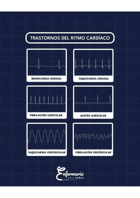 Trastornos Del Ritmo Card Aco Mar A Jos Gomes Enfermeriaparatodos