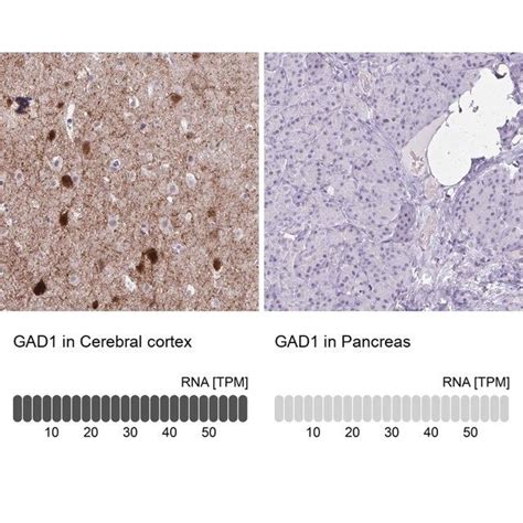 Anti Gad Antibody Produced In Rabbit