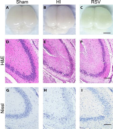 General Morphology Of The Brain And Hippocampus After Hypoxic Ischemic