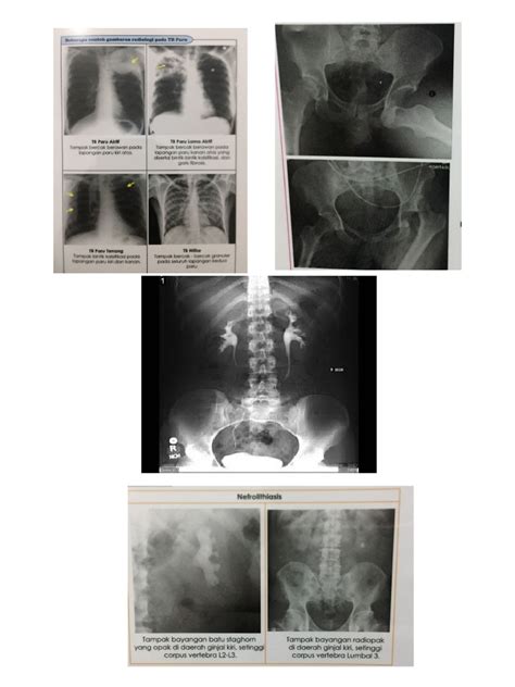 Gambar Klinis Radiografi Thorax Ls Pelvis Pdf