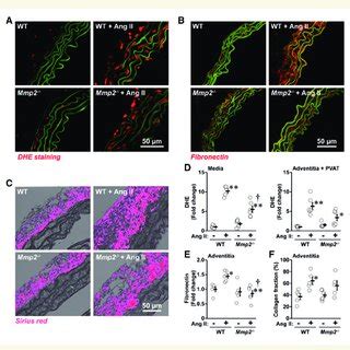 Mmp2 Gene Deletion Reduced Ang II Induced Reactive Oxygen Species ROS