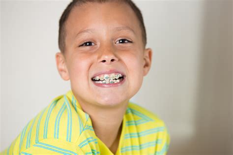 Be Vigilant With Your Childs Oral Health Belmar Orthodontics