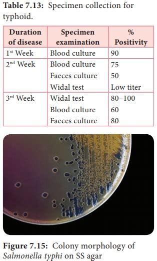 Salmonella Typhi Eberthella Typhi Morphology Cultural