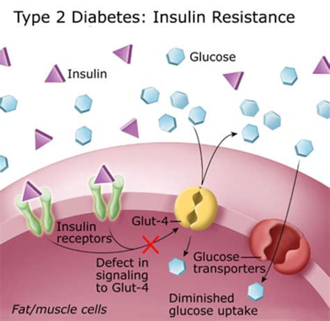 What Is Type 2 Diabetes Mellitus Or Non Insulin Dependent Diabetes