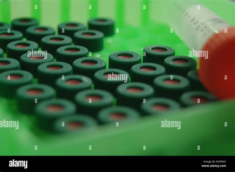 High Performance Liquid Chromatography Hplc Vials With Laboratory