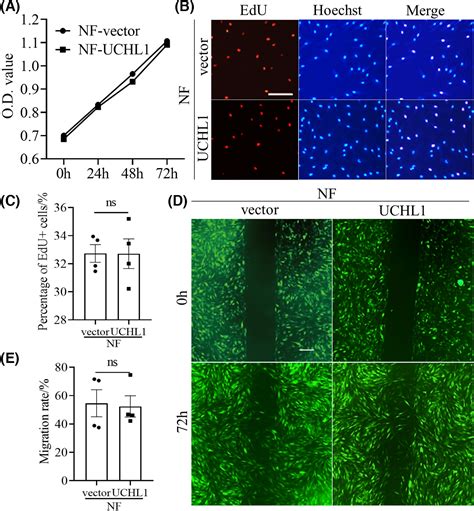 Uchl1 Aggravates Skin Fibrosis Through An Igf‐1‐induced Aktmtorhif‐1α