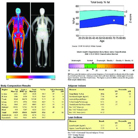 Body Composition Results Showing A Graphical Body Scan With Different