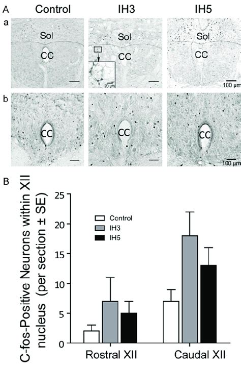 Effect Of Cih On C Fos Expression In The Xii Nucleus A Representative