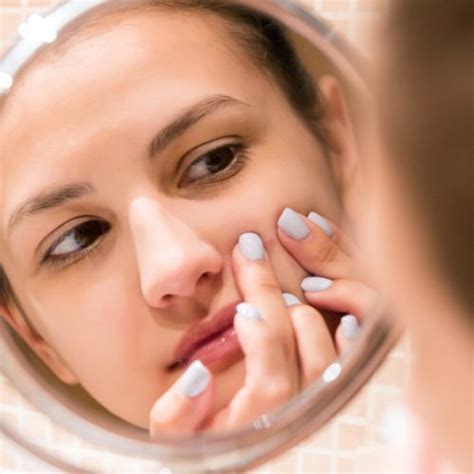 Understanding Blackheads Causes And Solutions