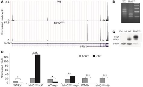 Jci 5′rna Seq Identifies Fhl1 As A Genetic Modifier In Cardiomyopathy