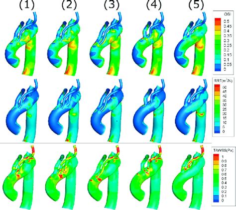 Oscillatory Shear Index Osi Relative Residence Time Rrt