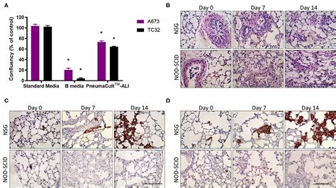 Frontiers Nsg Mice Facilitate Ex Vivo Characterization Of Ewing