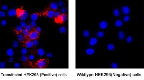 Human Siglec 2 CD22 LlamabodyTM VHH His Tag Antibody LMAB10732 By R D