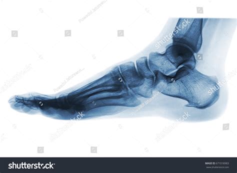 Xray Normal Human Foot Lateral View Stock Photo 671018983 Shutterstock