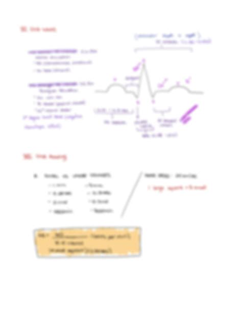 Solution Ekg Overview Studypool