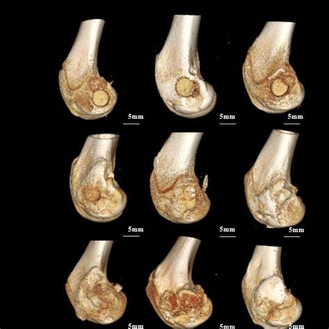 The Femoral Condyles Were Reconstructed At 4w 8w And 12w After Surgery Download Scientific