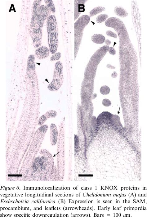 In Situ Expression Patterns Of Cmstm And Ecstm Mrna In Sections Of