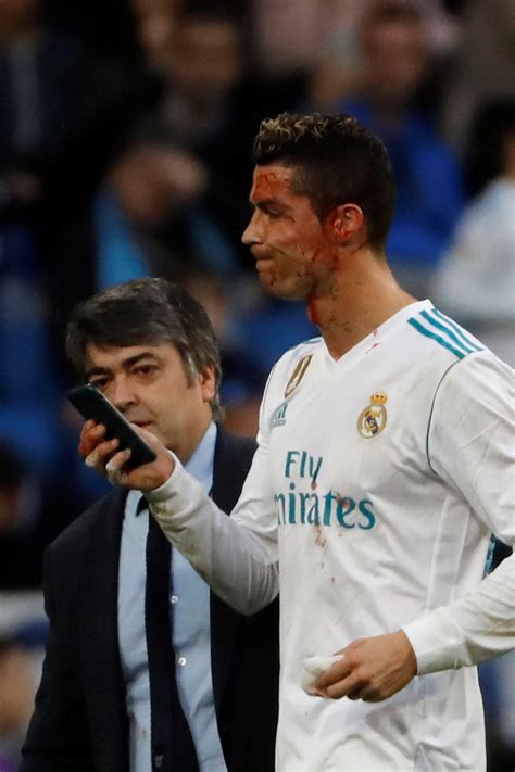 Photo Cristiano Ronaldo a reçu un coup de pied au visage lors du