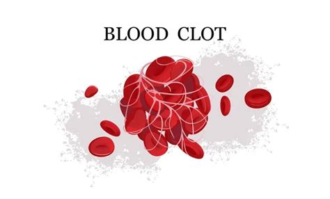 100,000 Clot Vector Images | Depositphotos