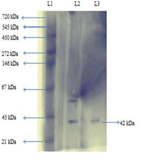 Purification And Properties Of An Esterase From Bacillus Licheniformis