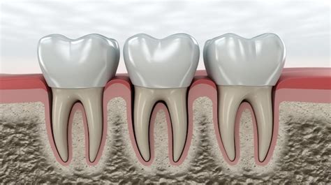 Imagem envolvente de pesquisa interativa de implantes dentários