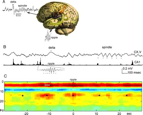 Hippocampus Neuroscience Journal Wiley Online Library