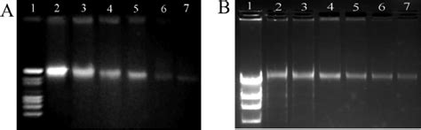 A Agarose Gel Electrophoresis Of E Coli Genomic DNA Extracted From