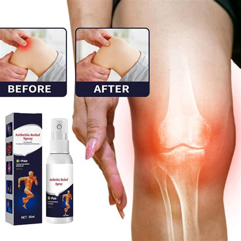 Arthritis Relief Spray Joint Aid Pain Relief Herbal Mist Pain Relief