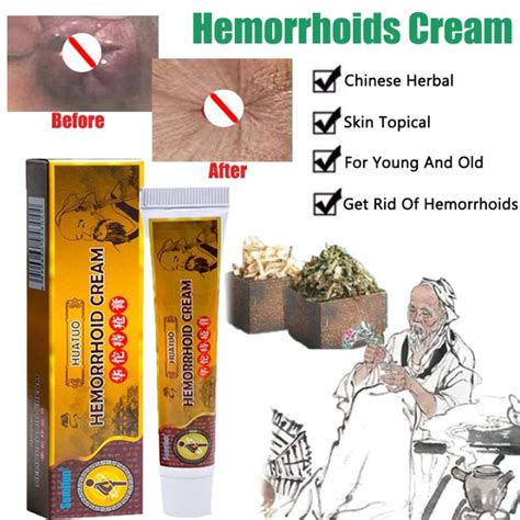 Manila Huatuo Origainal Hemorrhoids Cream Treatment Almoranas