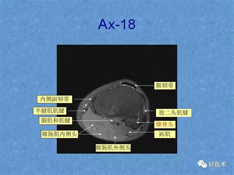 文章详情