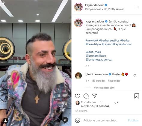 Novo Visual Kaysar Dadour Decide Pintar A Barba E Elogiado Por