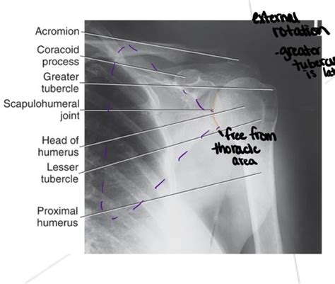 Shoulder Test Flashcards Quizlet