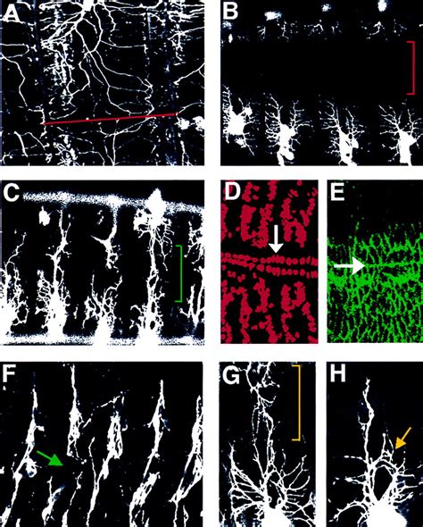 Genes Regulating Dendritic Outgrowth Branching And Routing In Drosophila